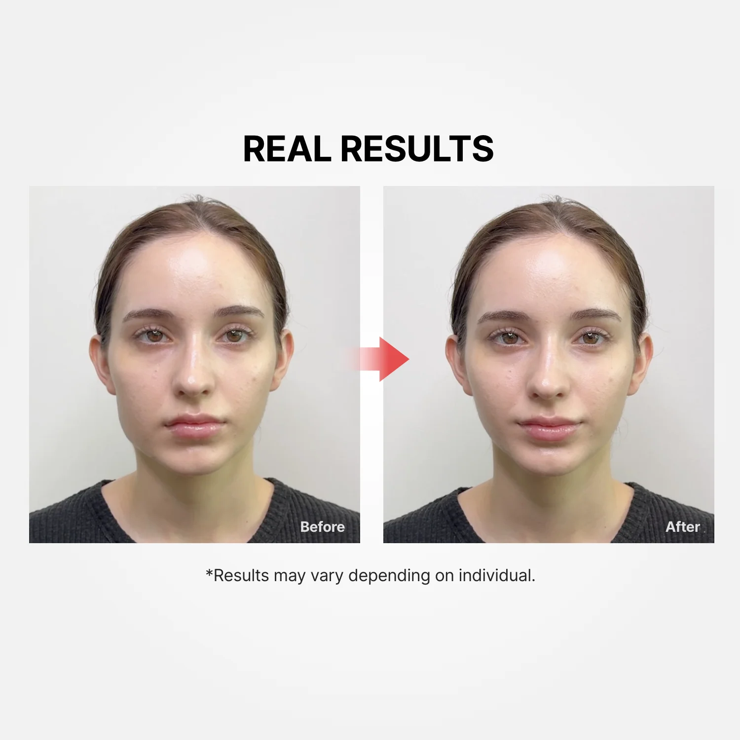 [Amazon] Shumage Gold Seal Lifting Cream + Device - Image 4