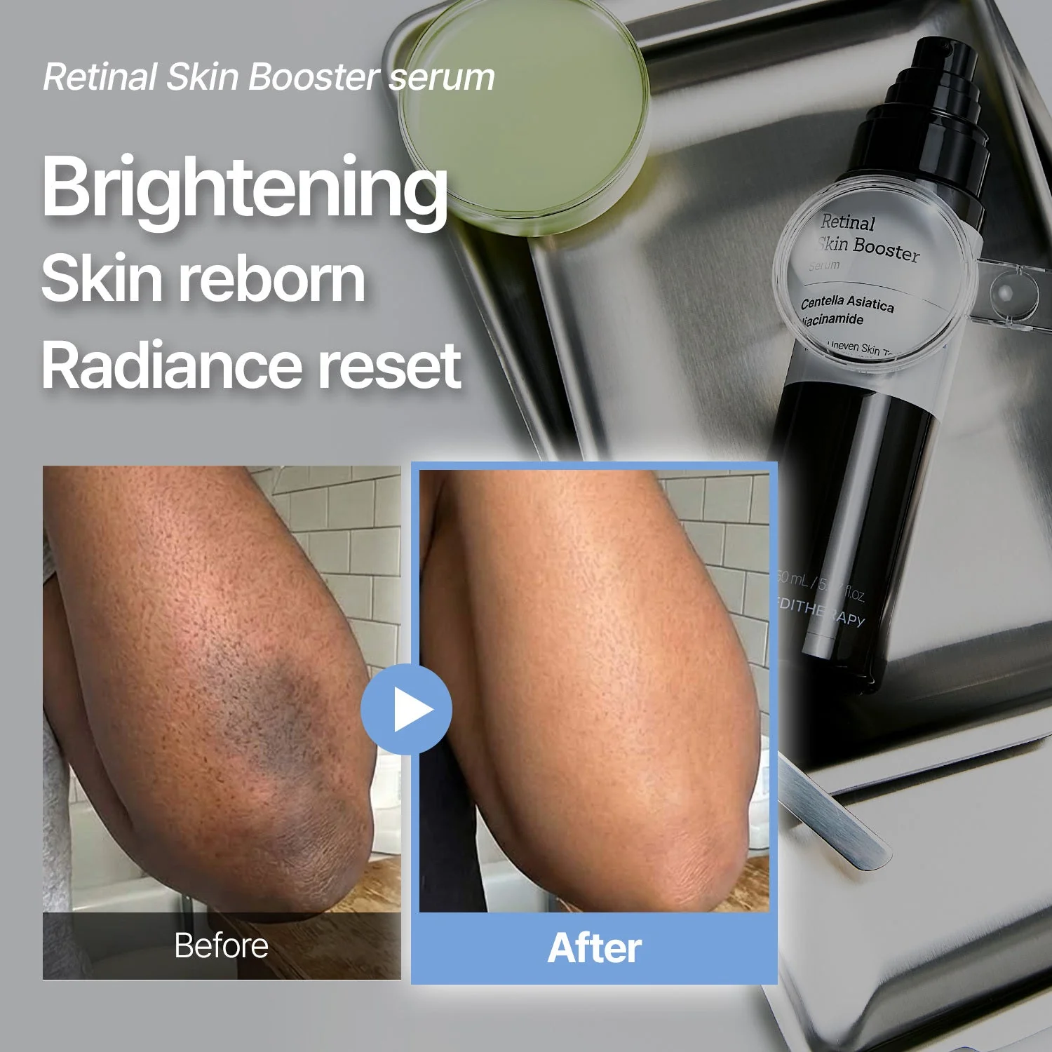 [Amazon #1]Retinal Skin Booster Serum - Dark Spot & Wrinkle care | Anti-aging - Image 3