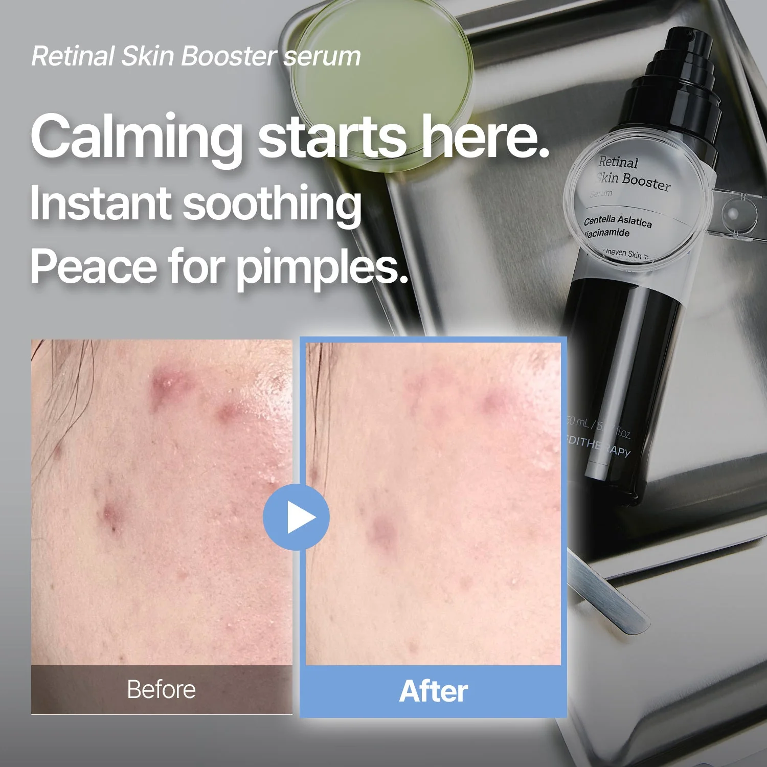 [AMAZON #1] Retinal Skin Booster Serum - Image 4