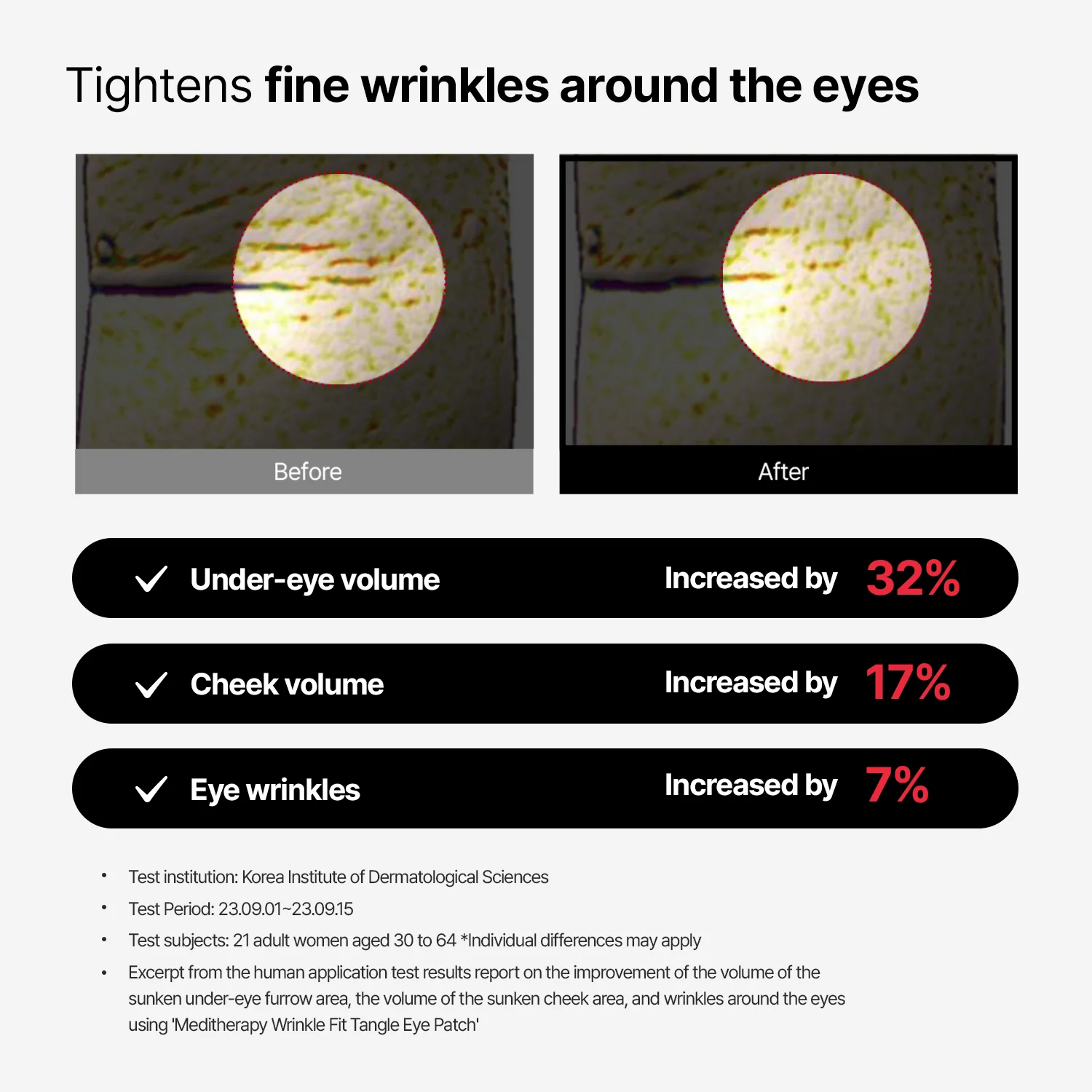 [30% OFF on Amazon] Wrinkle-Fit Tangle Eye Patch – Limited Stock - Image 4