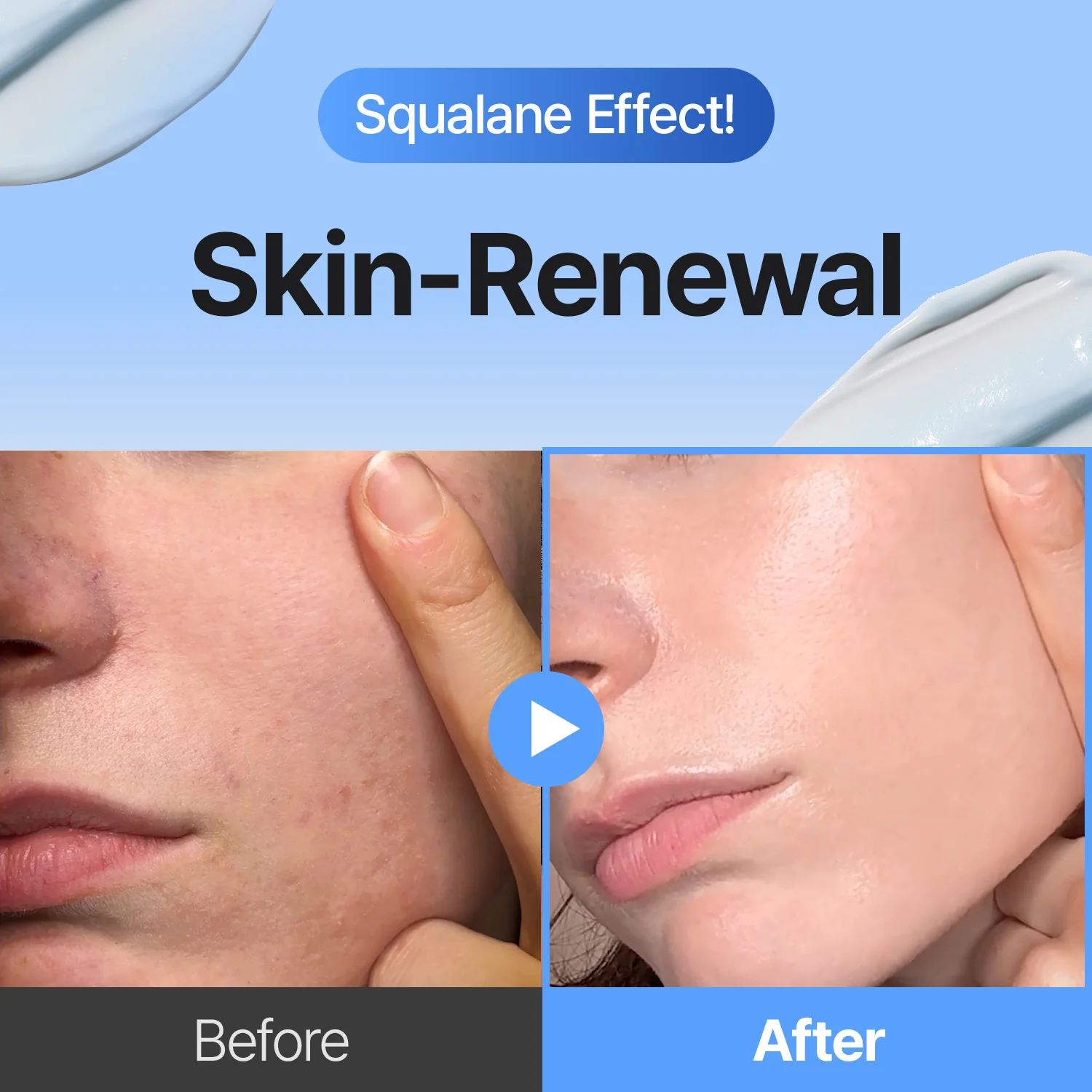 3-Step Korean Glass Skin Trio โ Retinal, Hyaluronic Acid & Squalane Moisturizer - Image 4