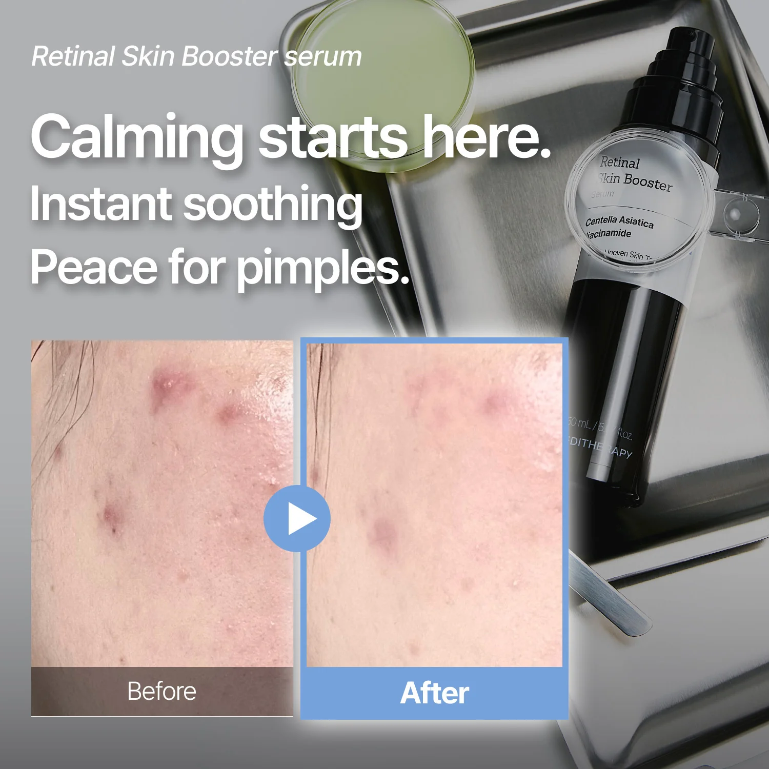 [Amazon #1]Retinal Skin Booster Serum - Dark Spot & Wrinkle care | Anti-aging - Image 4