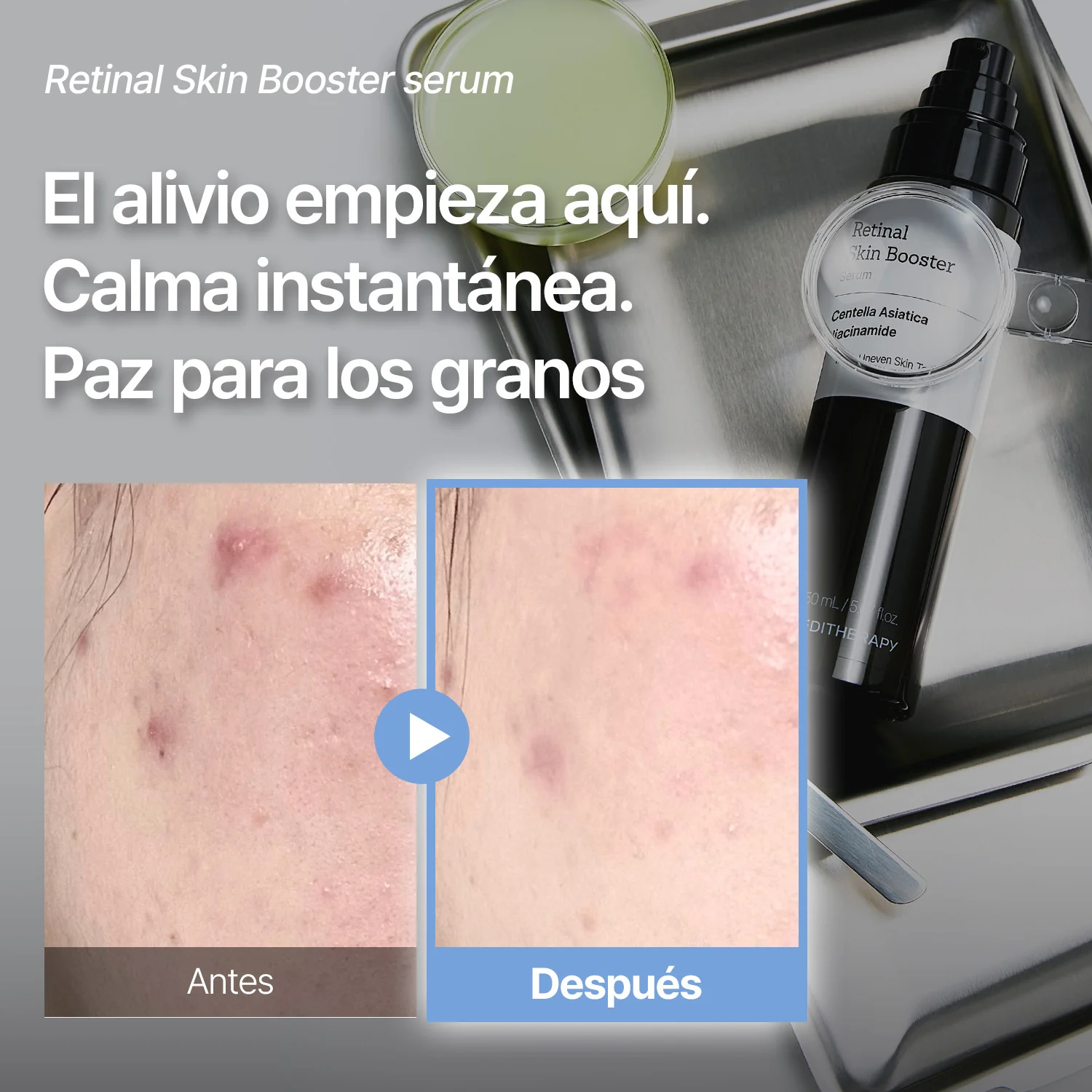 [Amazon n.º 1]Retinal Skin Booster Serum -Antimanchas y antiarrugas | Antiedad - Image 4