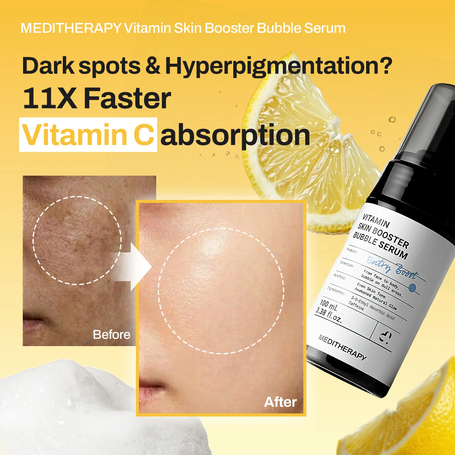 [Amazon's pick] Vitamin Bubble Serum – Even Tone & Dark Spot Fading