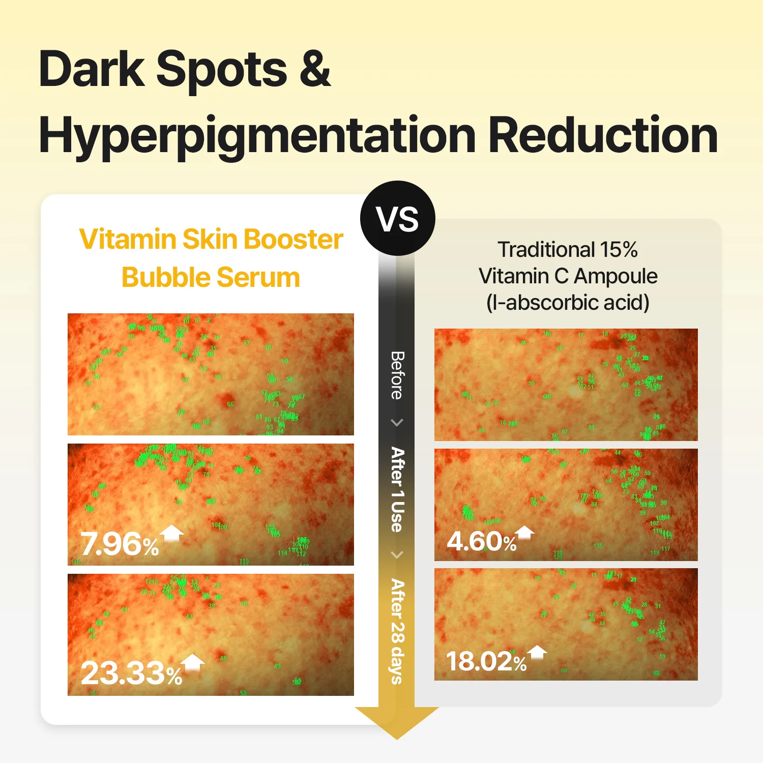 [Amazon's pick] Vitamin Bubble Serum – Even Tone & Dark Spot Fading - Image 2