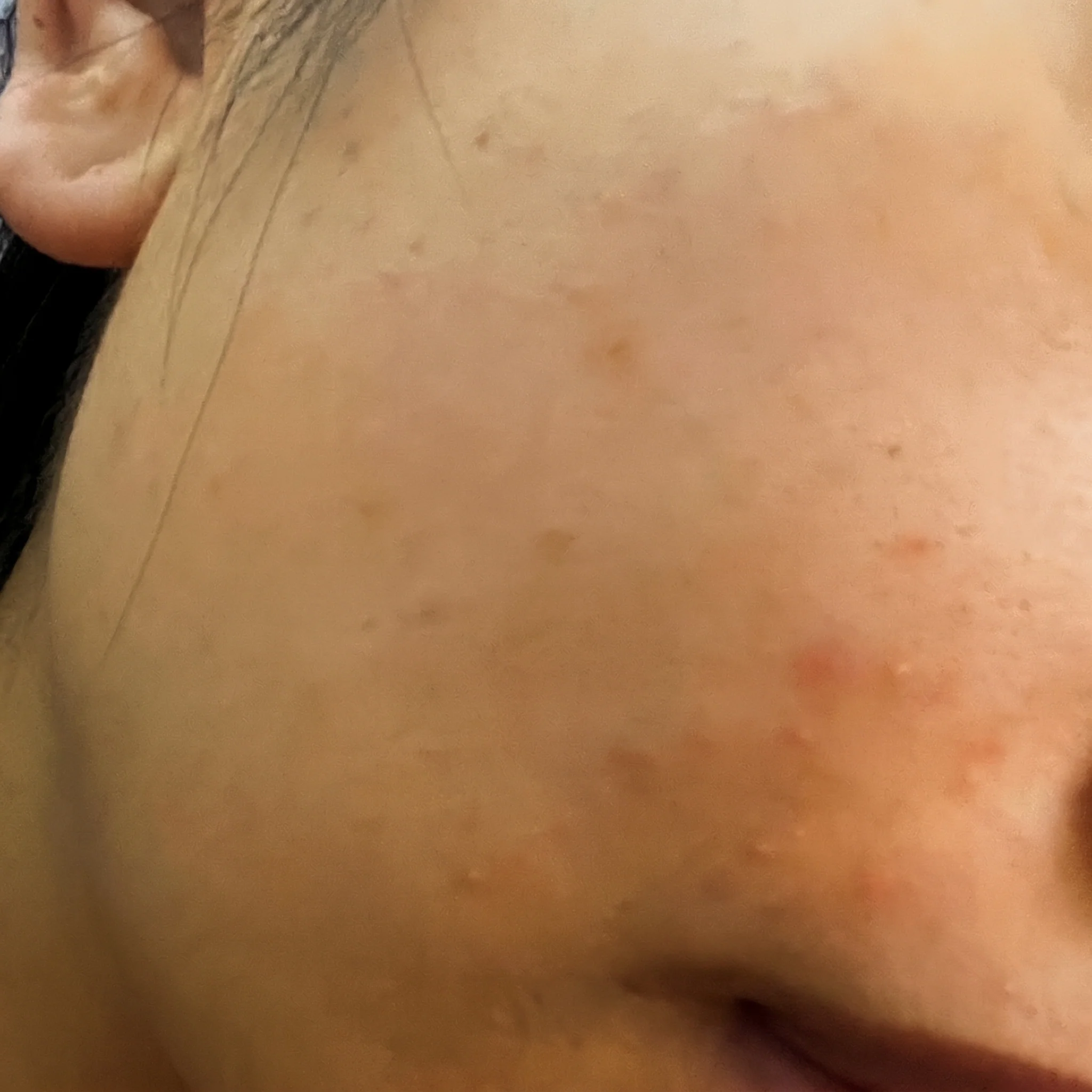 Hyaluronic Acid - Plump & Glow #1 K-Beauty Serum - Image 15
