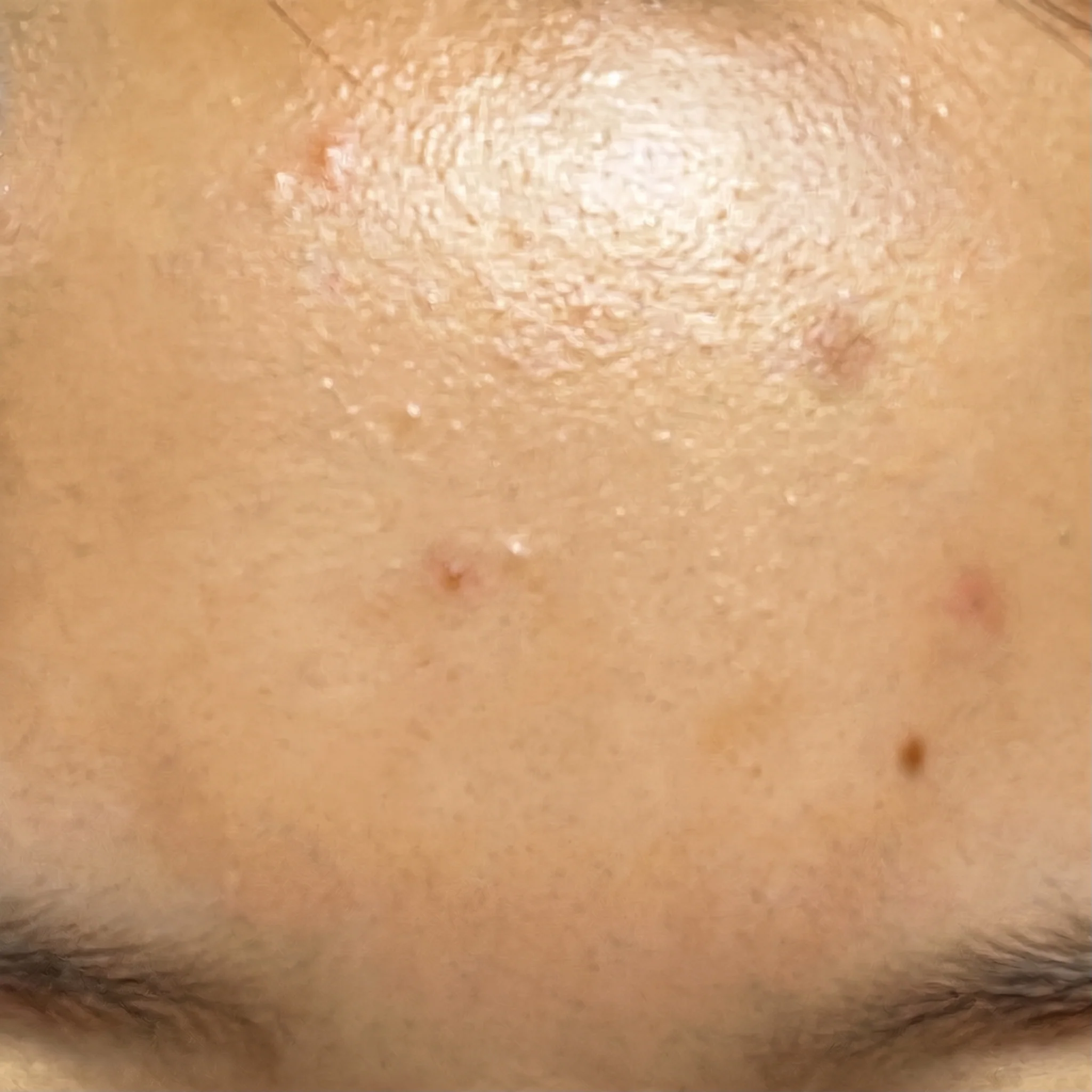 Hyaluronic Acid - Plump & Glow #1 K-Beauty Serum - Image 17