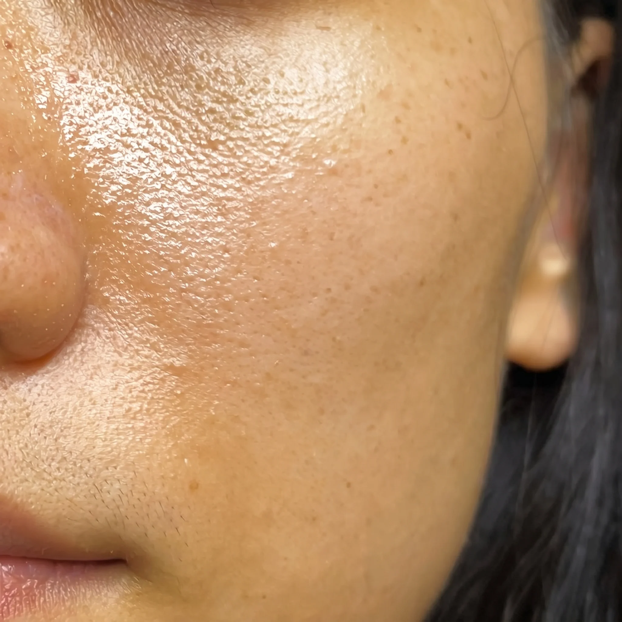 Hyaluronic Acid - Plump & Glow #1 K-Beauty Serum - Image 20