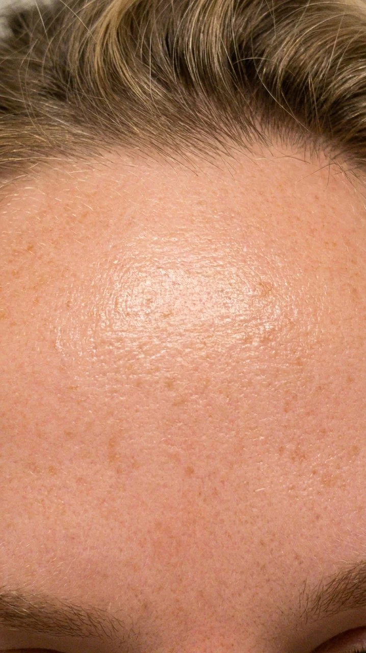 Hyaluronic Acid - Plump & Glow #1 K-Beauty Serum - Image 43