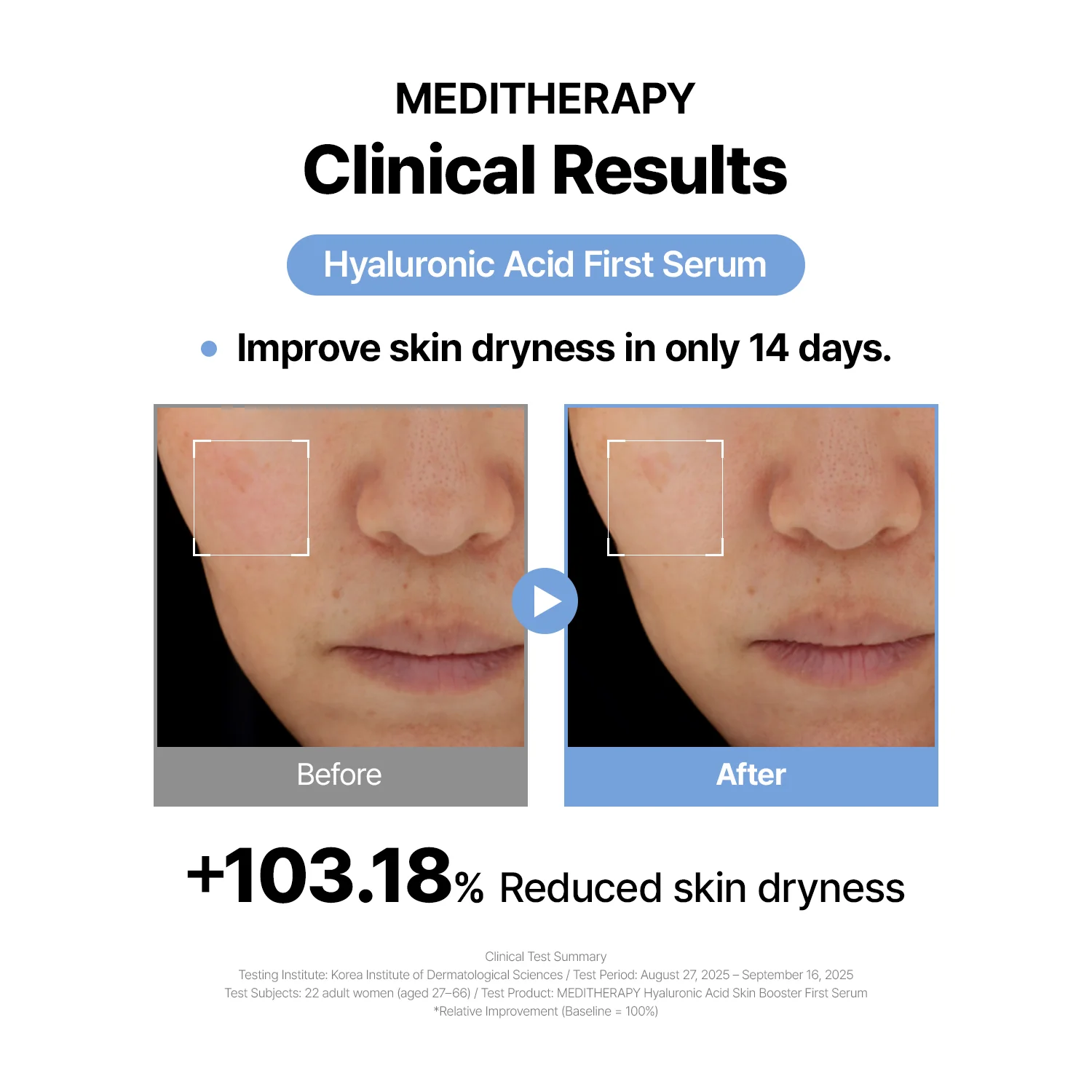Hyaluronic Acid - Plump & Glow #1 K-Beauty Serum - Image 5