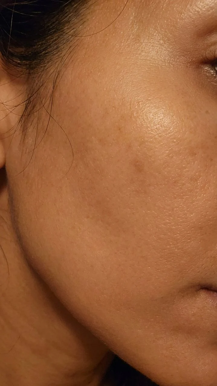 Hyaluronic Acid - Plump & Glow #1 K-Beauty Serum - Image 55