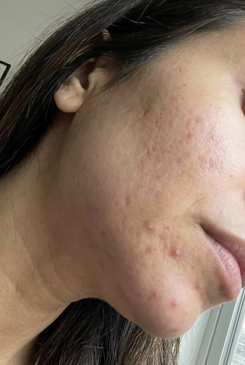Hyaluronic Acid - Plump & Glow #1 K-Beauty Serum - Image 56