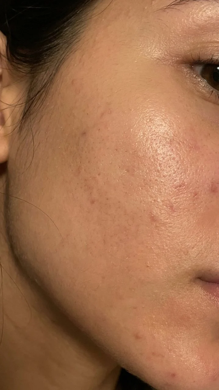 Hyaluronic Acid - Plump & Glow #1 K-Beauty Serum - Image 58