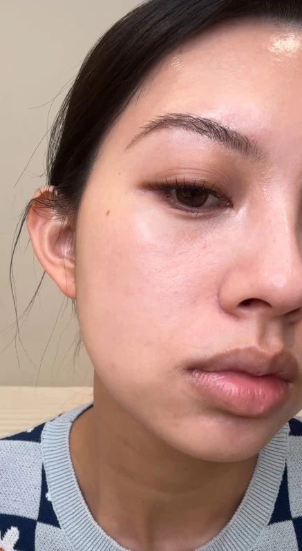 Hyaluronic Acid - Plump & Glow #1 K-Beauty Serum - Image 90