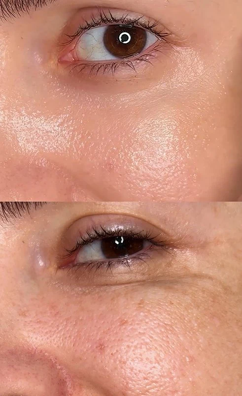Hyaluronic Acid - Plump & Glow #1 K-Beauty Serum - Image 94