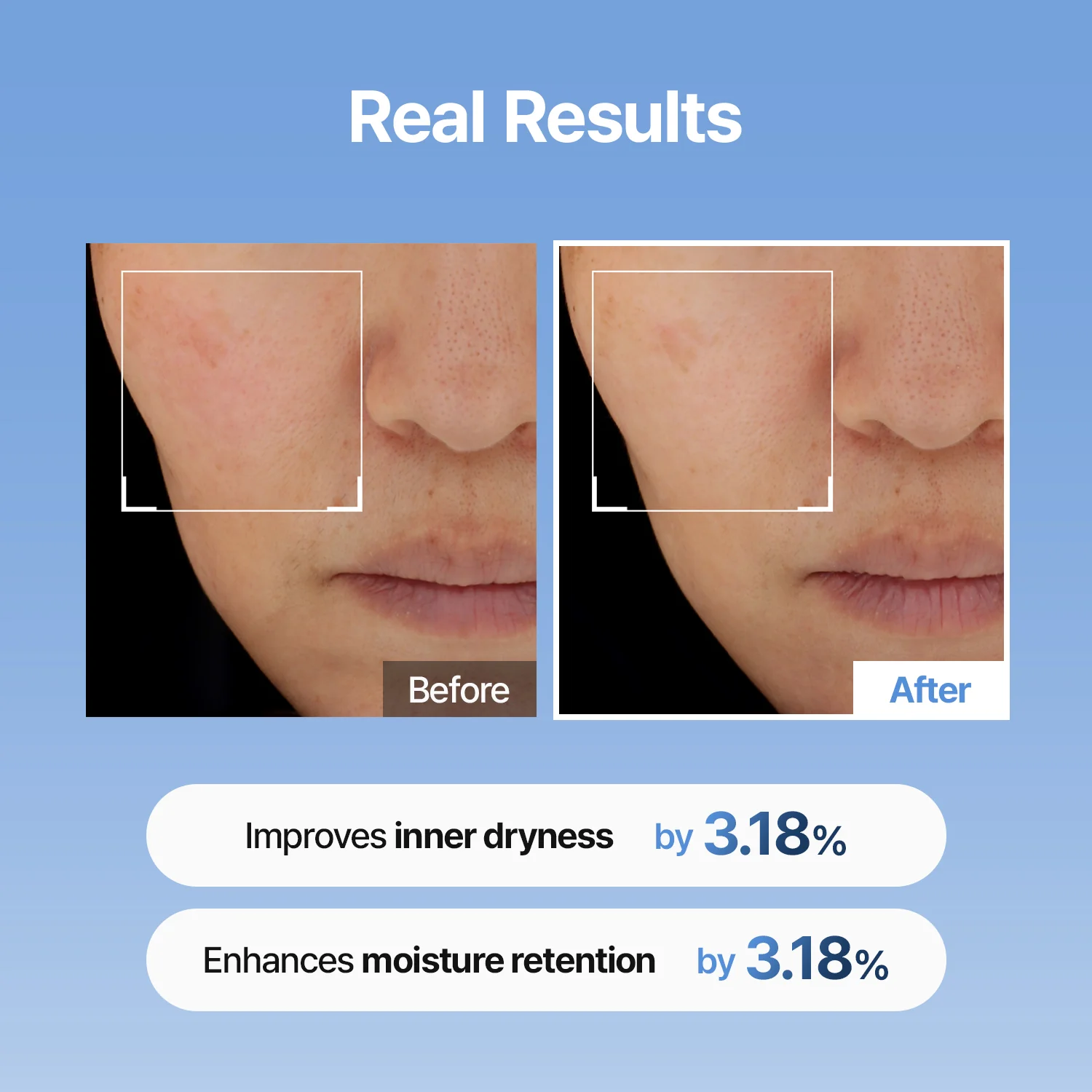 Hyaluronic Acid Skin Booster First Serum - Image 3