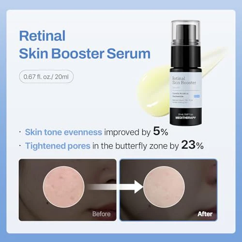 Meditherapy Gentle Boost Kit – Retinal & Hyaluronic Acid Serum & Squalane Moisturizer Set _ TEST - Image 5