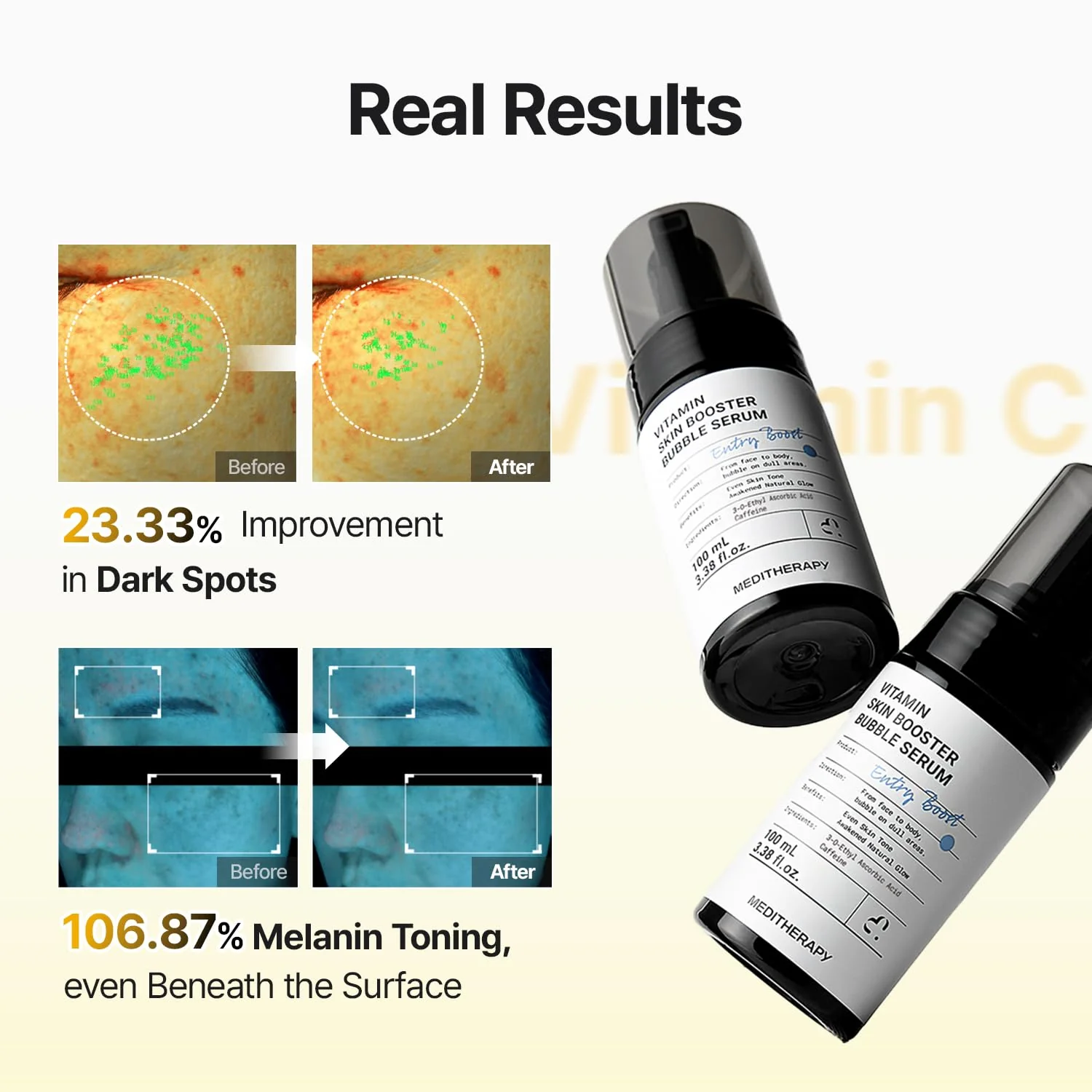 [Amazon | New drop] Vitamin Skin Booster Bubble Serum – Non-Irritating Gentle Daily Brightening - Image 3