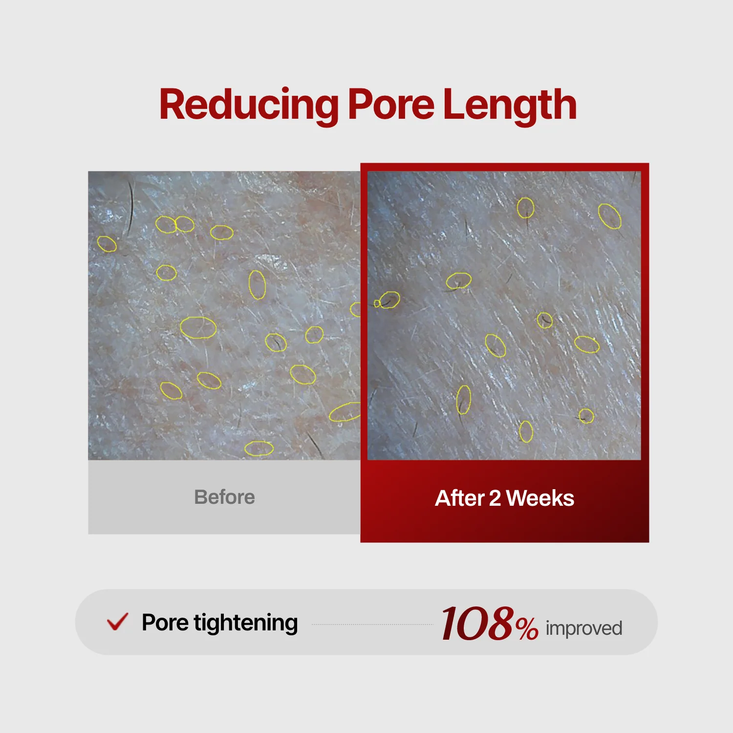 Wrinkle-fit Mask(hidden) - Image 10