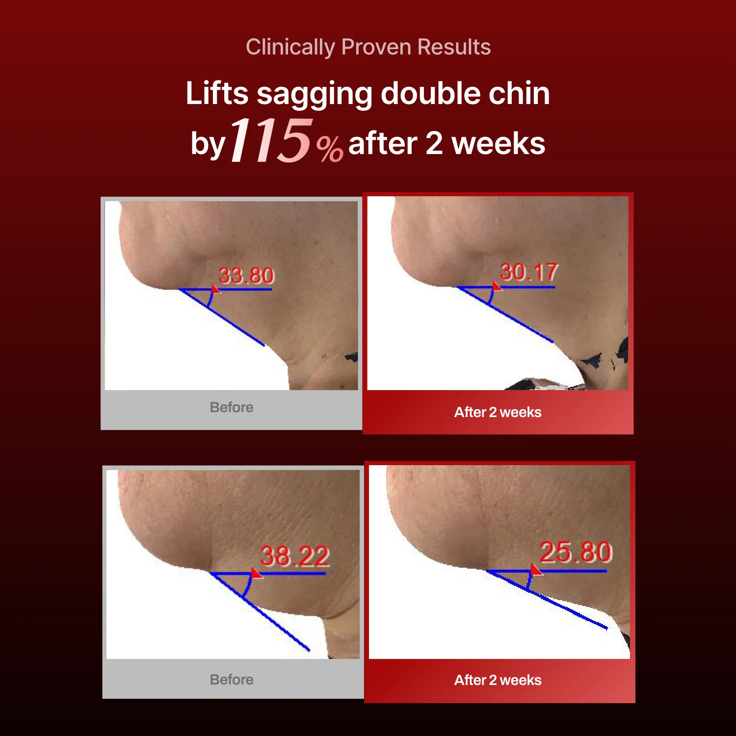 Wrinkle-fit Mask(hidden) - Image 11
