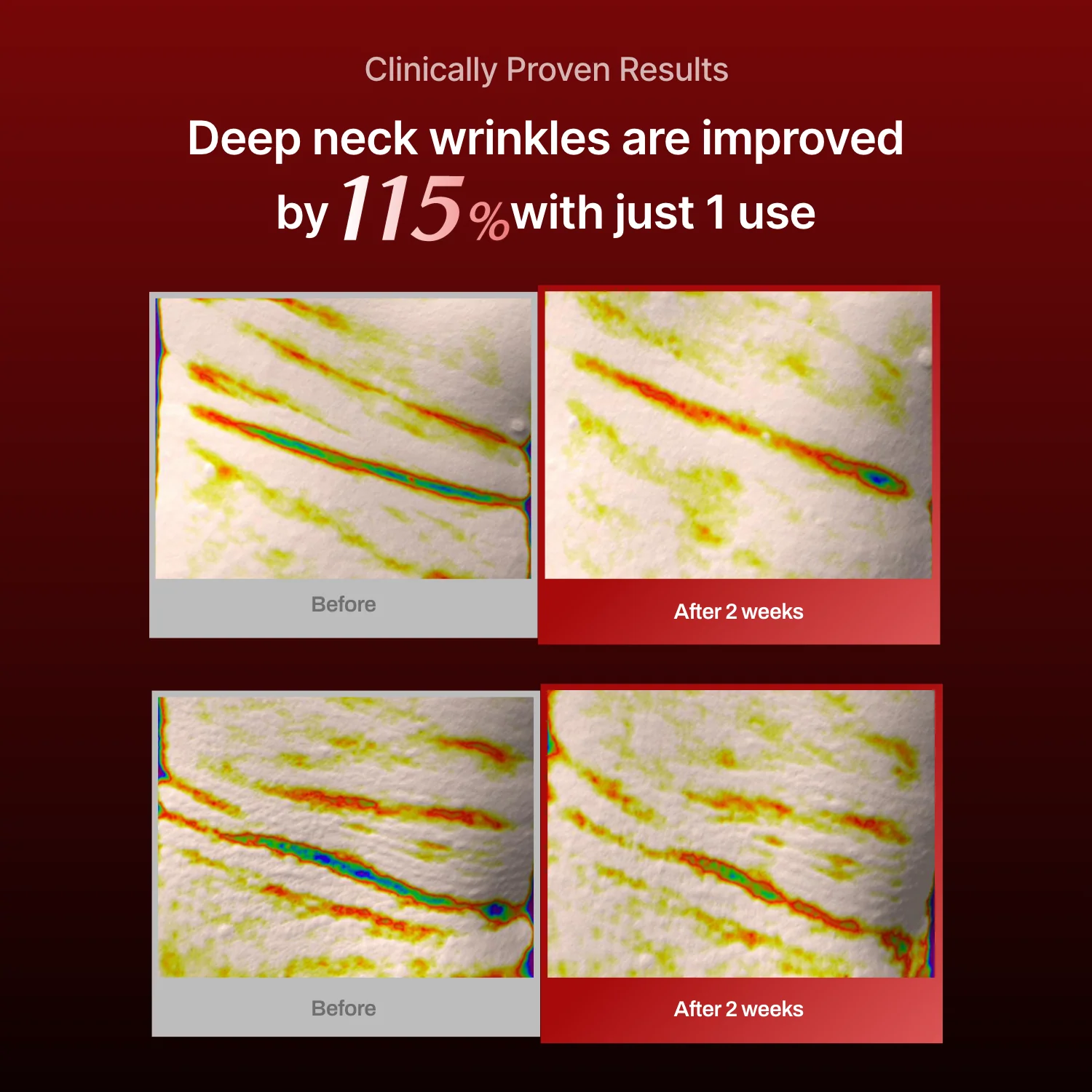 Wrinkle-fit Mask(hidden) - Image 12