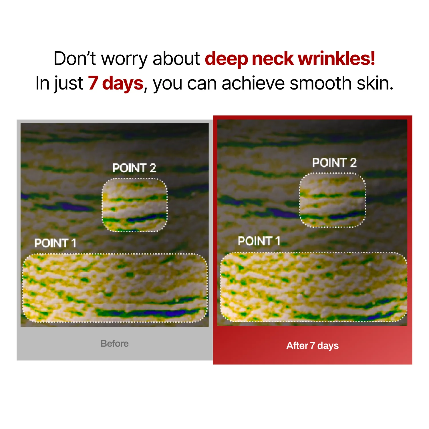 Wrinkle-fit Mask(hidden) - Image 13