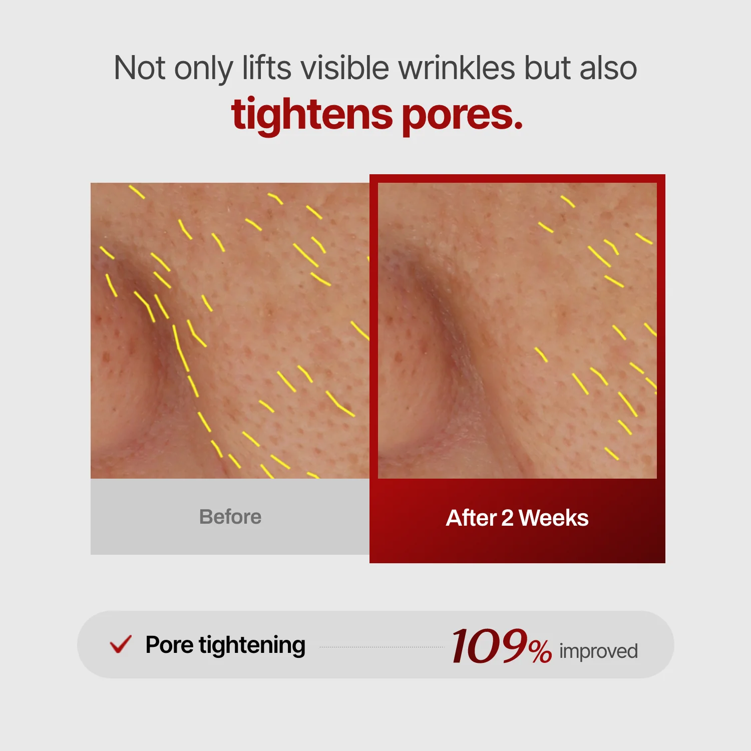 Wrinkle-fit Mask(hidden) - Image 9